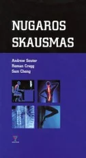 Nugaros skausmas — gamta-mokslai