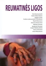 Reumatinės ligos