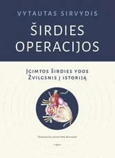 ŠIRDIES OPERACIJOS. Įgimtos širdies ydos. Žvilgsnis į istoriją — gamta-mokslai